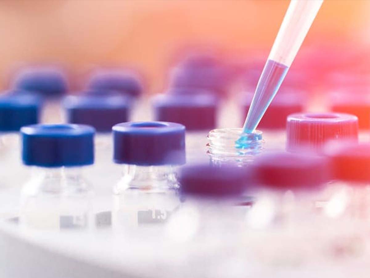 Image of lab test tubes