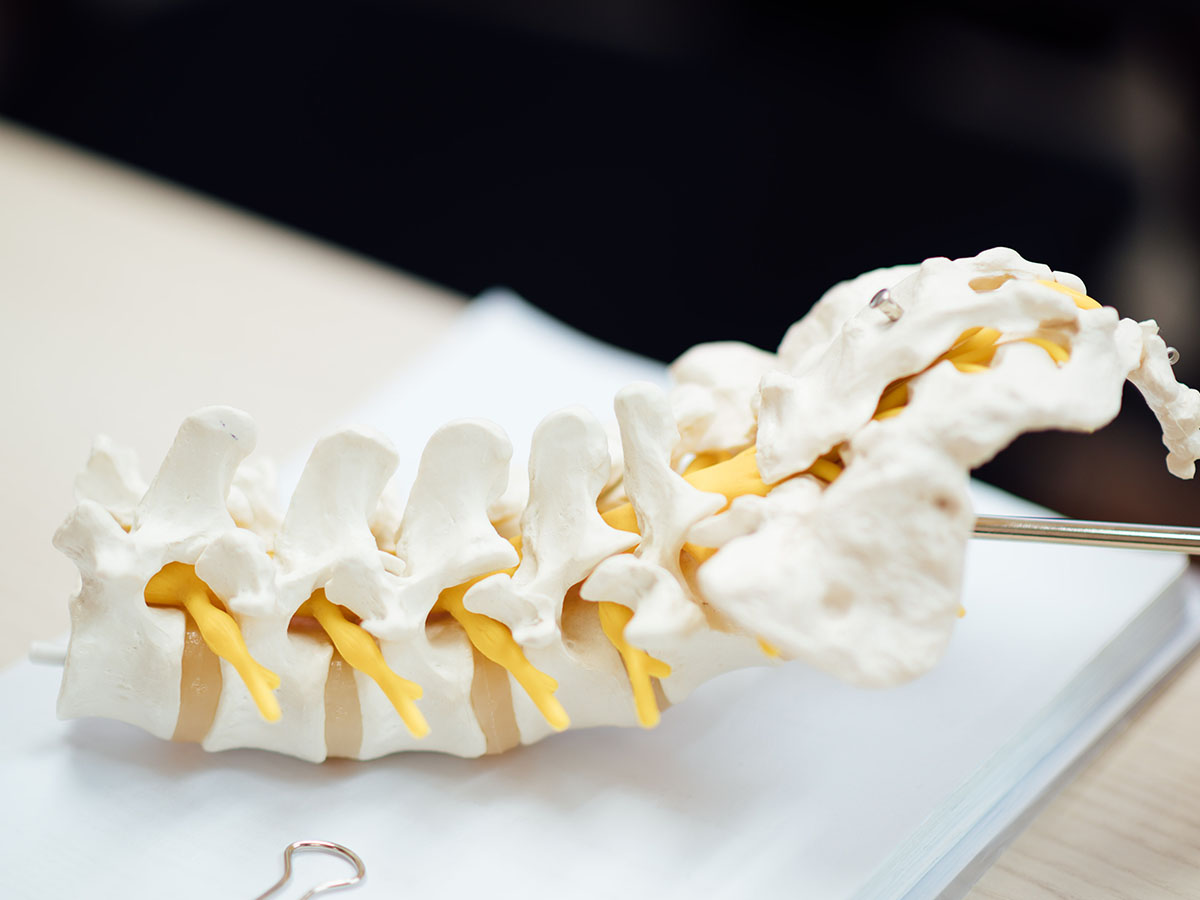 Lumbar Spinal Stenosis